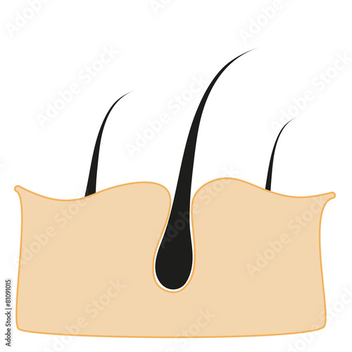 pore