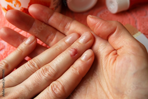 The cut on his finger and plaster for wounds.
