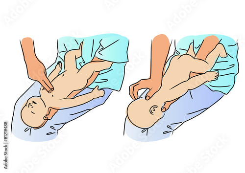 CPR - Children's first aid