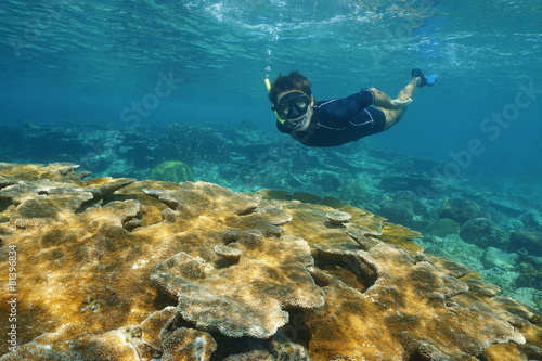 Man snorkeling underwater over tropical reef