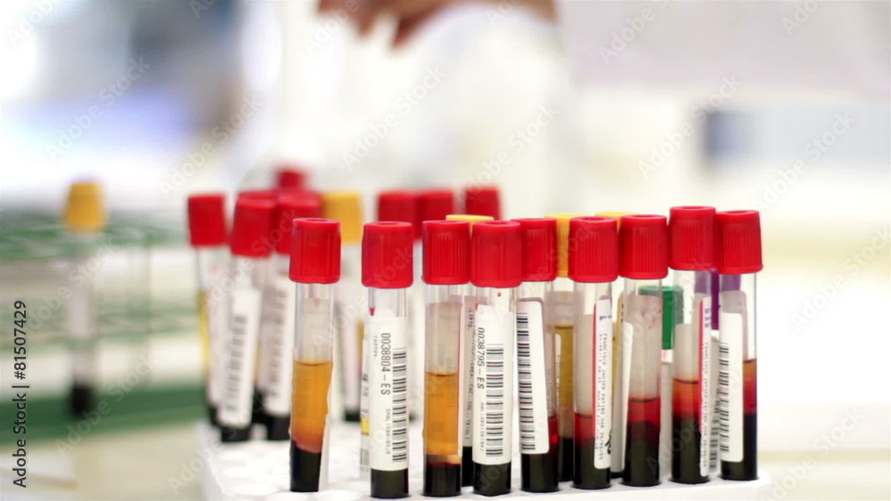 Blood test tubes being analyzed and interchanged by a laboratory worker Blood test tubes being analyzed and interchanged by a laboratory worker