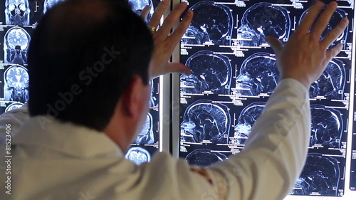 Mexico 2014: Close Up-Back Shoulder. Doctor Looking A Brain Scan.