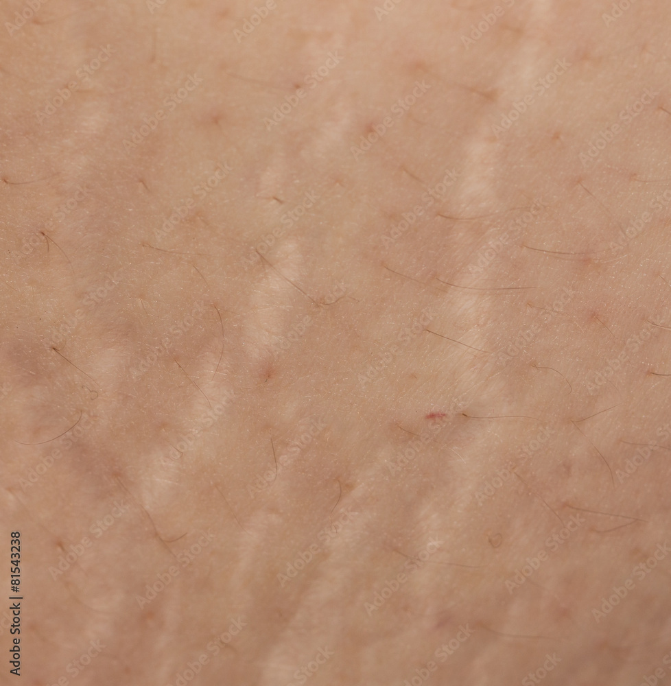 Fototapeta premium stretch marks on the abdomen as background