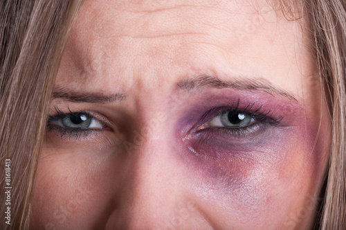 Sad eyes of a domestic violence victim