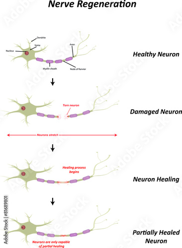 Nerve Regeneration photo