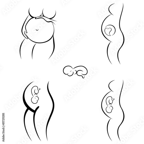 Schwangerschaft - silhouette set