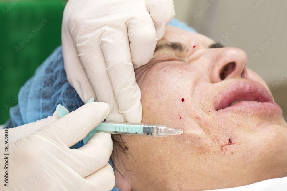 Cosmetic treatment with injection in a clinic Cosmetic treatment with injection in a clinic