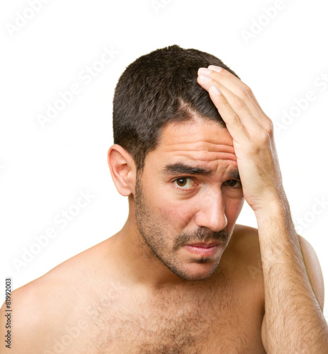 Young man concerned about hair loss