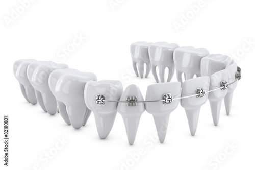 dental brackets #82180831