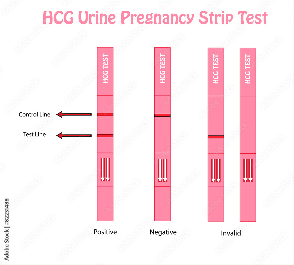 Pregnancy Urine Tests