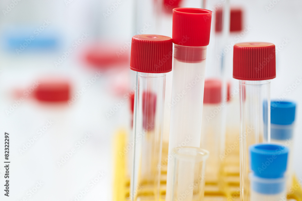 test tubes in the laboratory test tubes in the laboratory