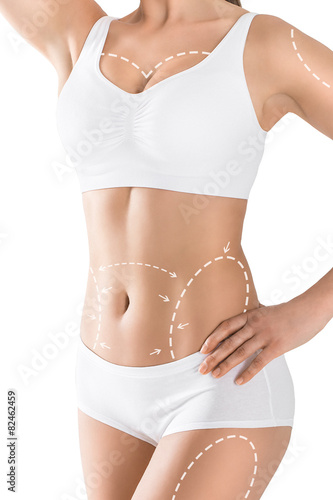 Woman's body marked out for cosmetic surgery. Isolated on white.