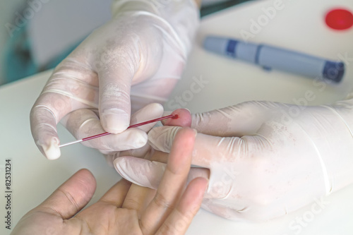 Blood capillary test