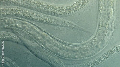 A free-living, transparent nematode (roundworm) photo