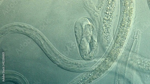 Roundworm, a free-living, transparent nematode photo