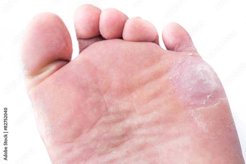 Fototapeta premium corn on foot