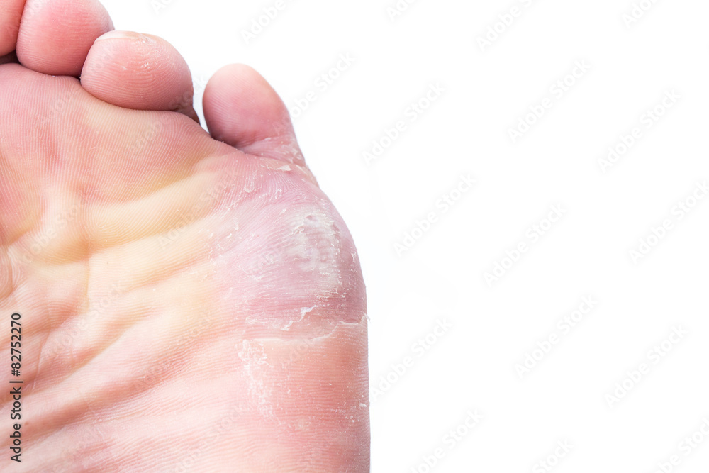 Fototapeta premium corn on foot