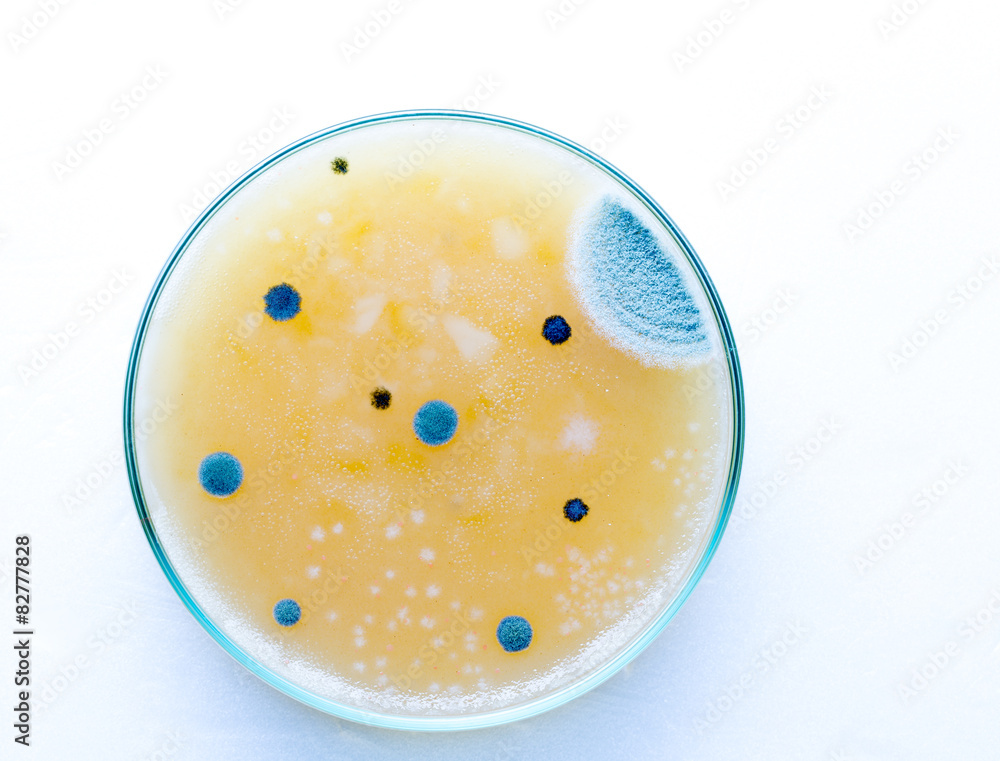 Petri dish with pathological microbe colonies Petri dish with pathological microbe colonies