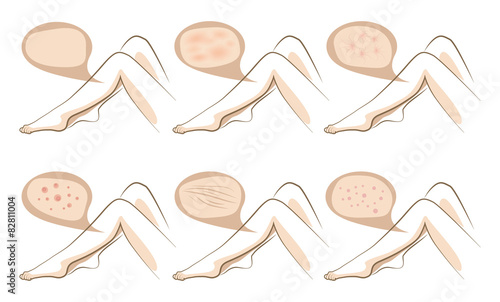 Legs concept of anti aging procedures on skin