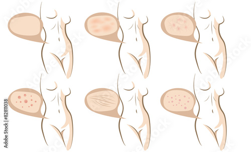Body concept of anti aging procedures on skin