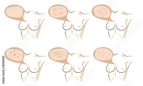 Body concept of anti aging procedures on skin