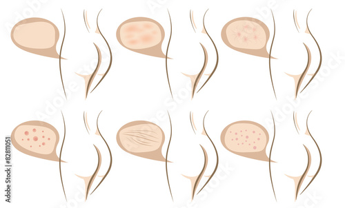 Body concept of anti aging procedures on skin