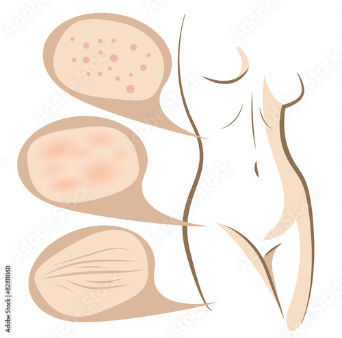 Body concept of anti aging procedures on skin