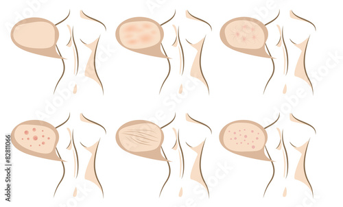 Body concept of anti aging procedures on skin
