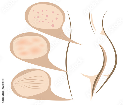 Body concept of anti aging procedures on skin