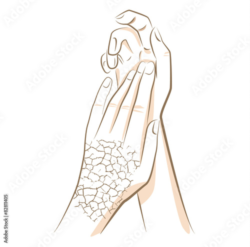 Concept of dry and cracked skin woman hands