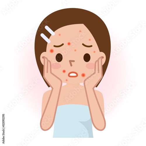 美容 ニキビ 女性