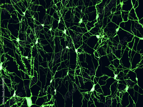 Obraz na plátne Fluoreszenz markierte Neuronen