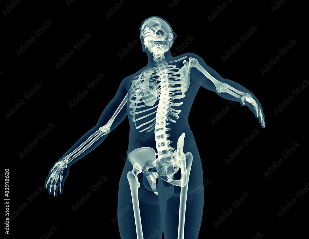 x-ray image of a human body