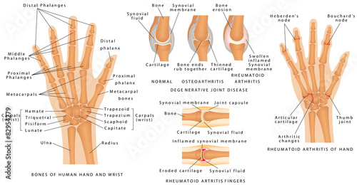 Skeletal System Phalanges