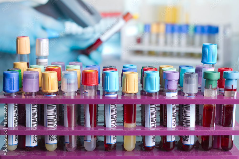 Tray tubes with blood samples labeled / rack of blood tubes Tray tubes with blood samples labeled / rack of blood tubes