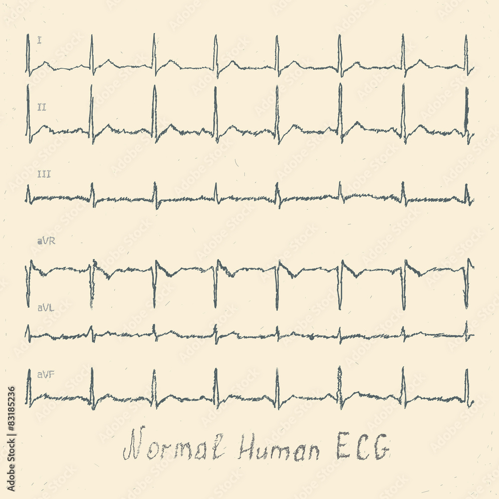 Normal human ECG hand-drawn vector