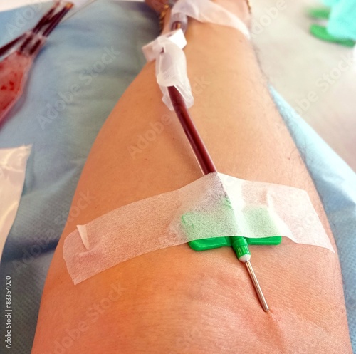 blood donor during the transfusion at the hospital 