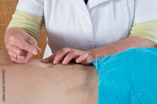Close-up of woman's hands doing acupuncture on a man