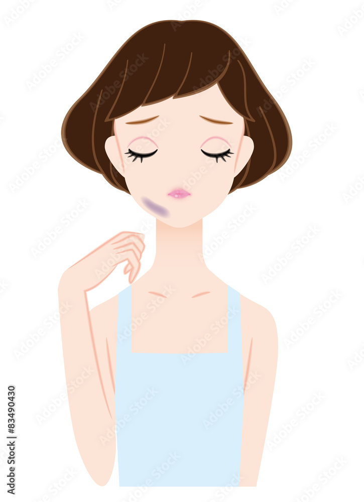 痣に悩む女性 痣に悩む女性