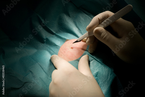 Germany, Surgeon with scalpel photo