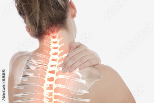 Highlighted spine of woman with neck pain photo
