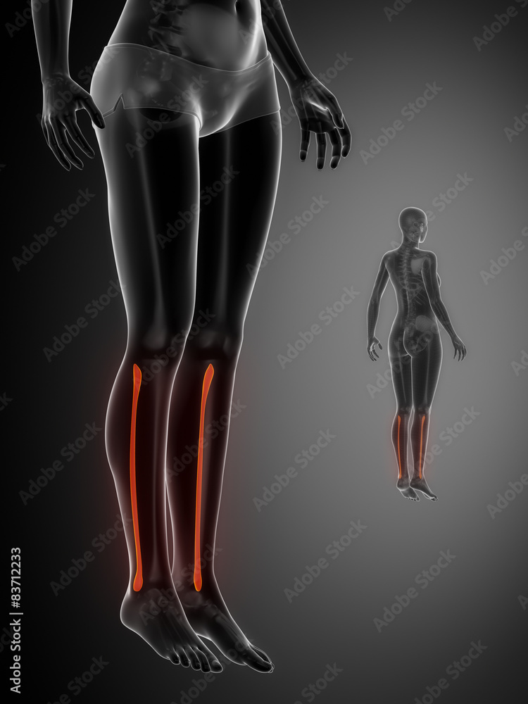 FIBULA black x--ray bone scan FIBULA black x--ray bone scan