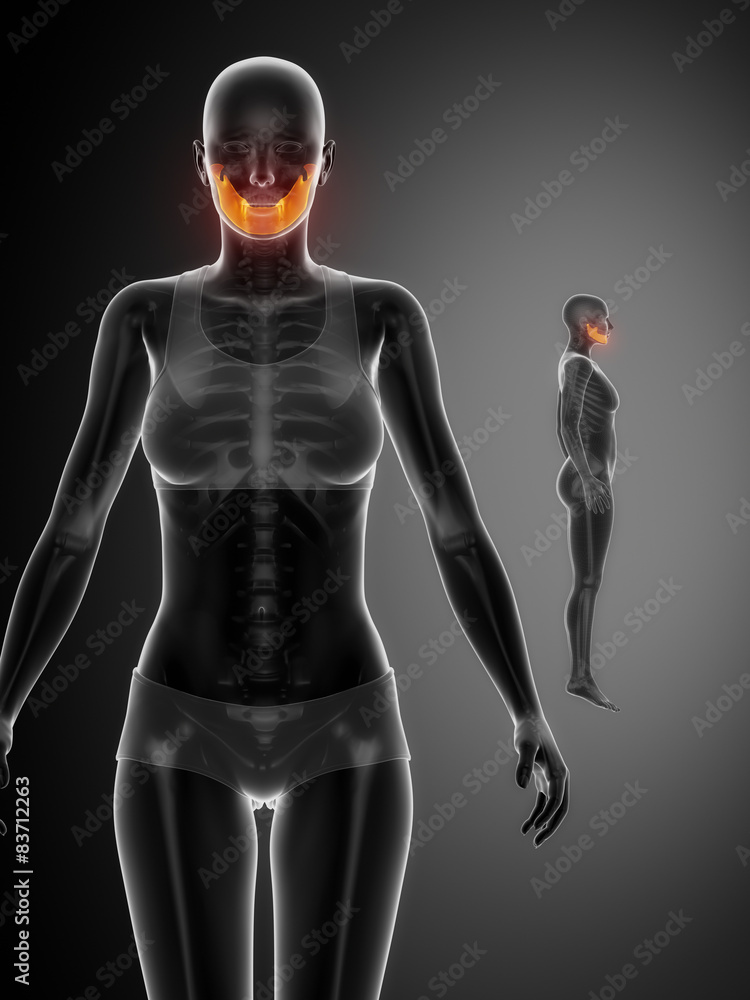 MANDIBLE black x--ray bone scan MANDIBLE black x--ray bone scan