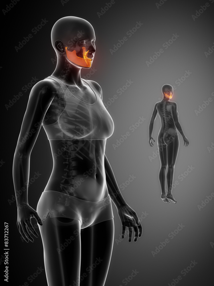 MANDIBLE black x--ray bone scan