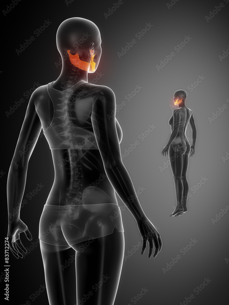 MANDIBLE black x--ray bone scan MANDIBLE black x--ray bone scan