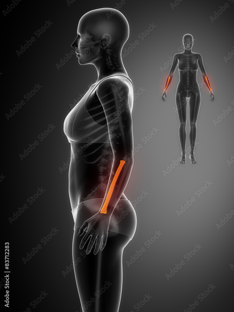 RADIUS black x--ray bone scan RADIUS black x--ray bone scan