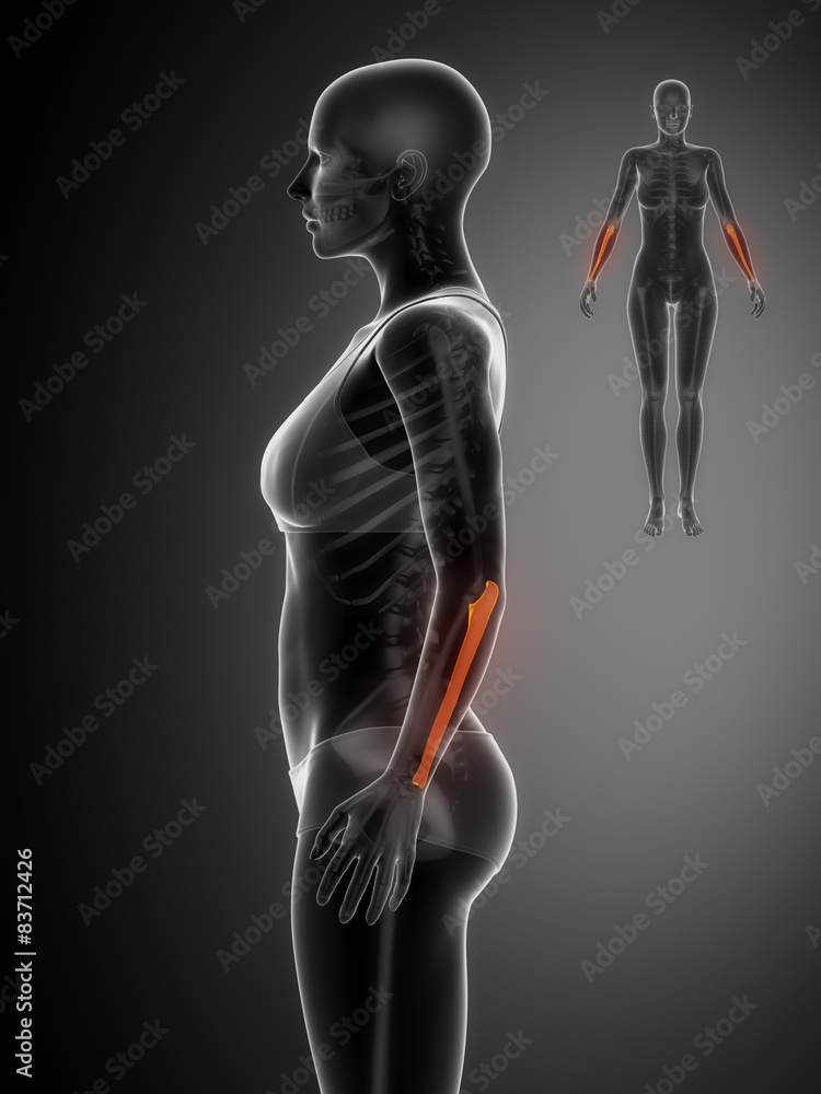 ULNA black x--ray bone scan ULNA black x--ray bone scan