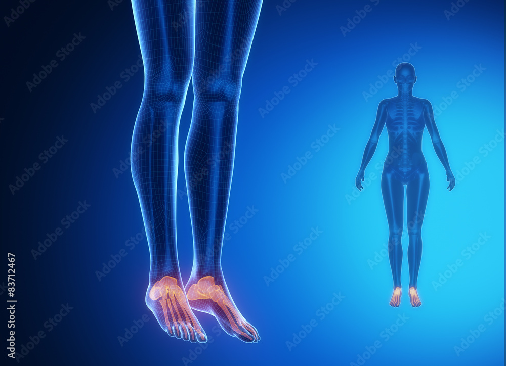 ANKLE blue x--ray bone scan