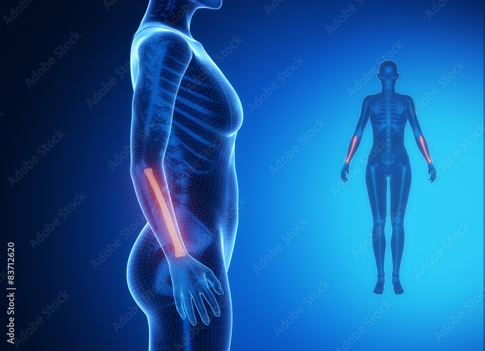 RADIUS blue x--ray bone scan RADIUS blue x--ray bone scan