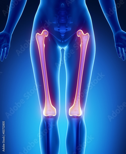 FEMUR blue x--ray bone scan photo